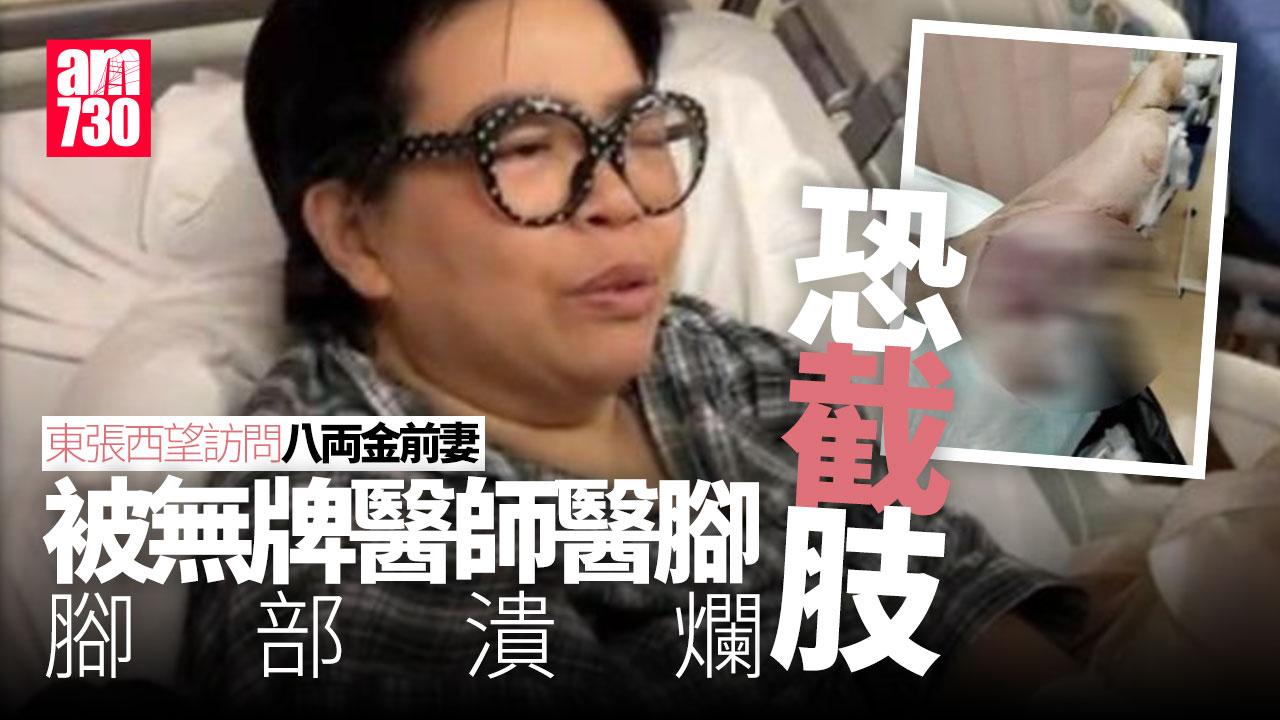 東張西望｜八両金前妻被無牌醫師醫腳 腳部潰爛恐截肢