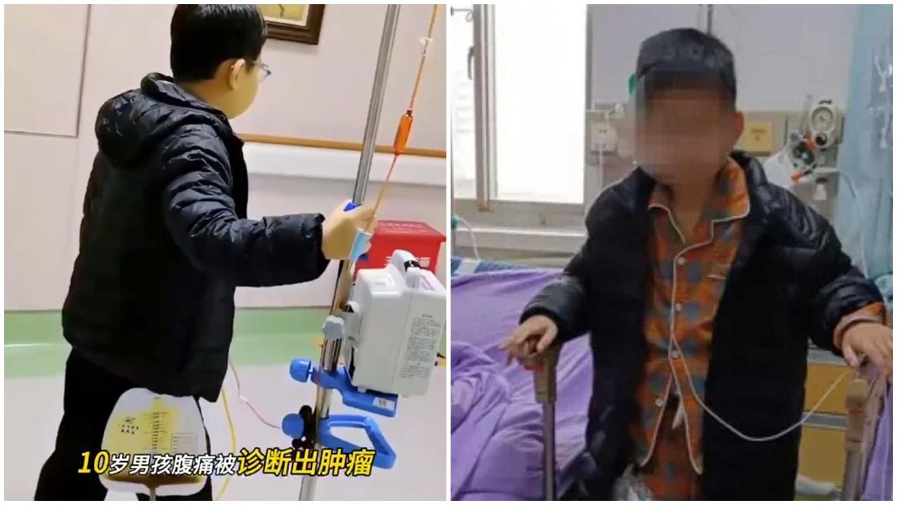 山東10歲男童腹痛就醫，一個手術6個器官遭切除。(微博)