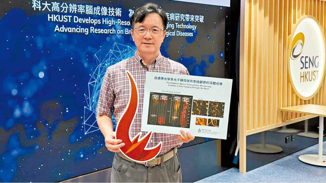 研MD-FSS技術 清晰觀察小鼠大腦動態變化  科大團隊︰為人類神經疾病研究帶來突破 