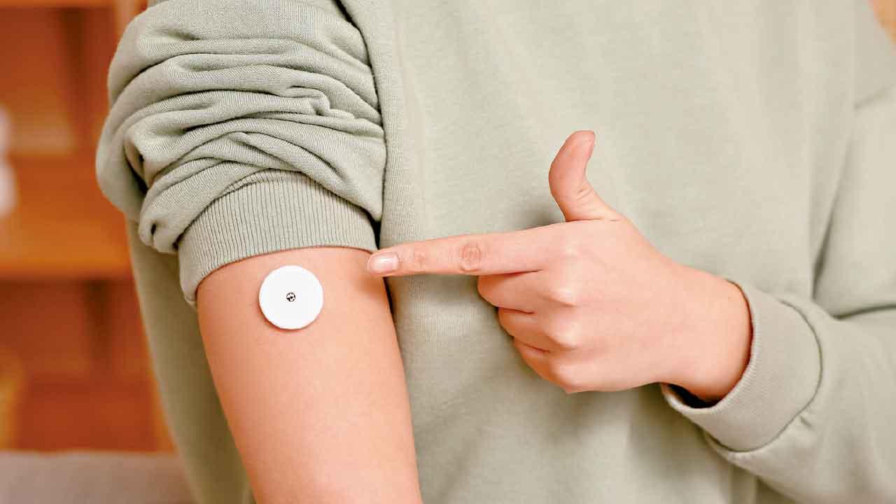 新型CGM 助避免低血糖