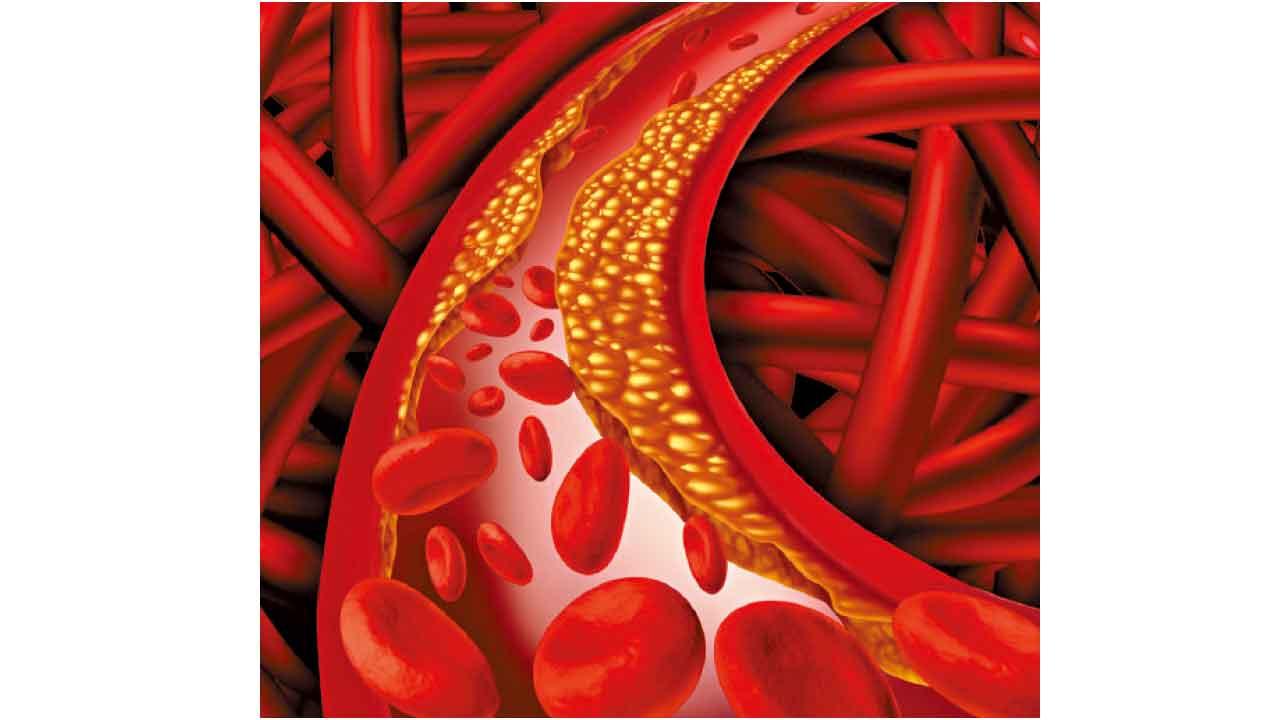 膽固醇是怎樣吃進身體的
