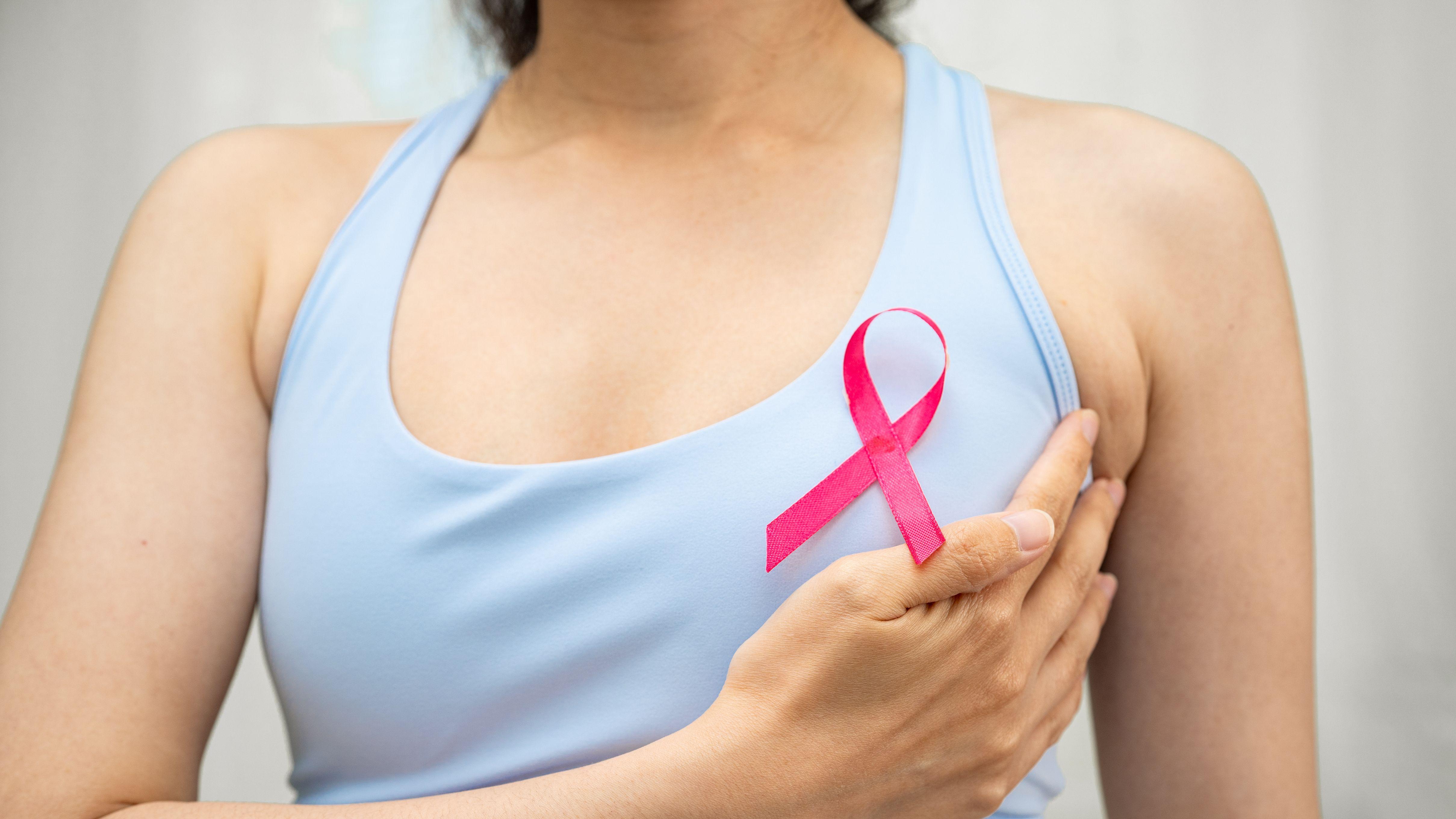 2023年香港癌症統計：癌症新症創新高　乳癌持續攀升需警覺