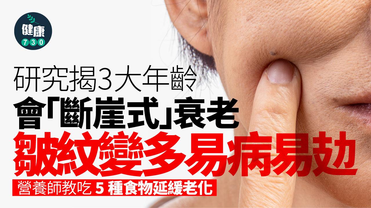 延緩老化 衰老 老化 大腦衰老 皺紋 失智 腦退化