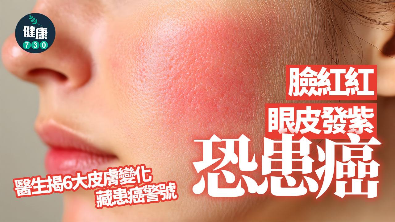 塑膠微粒 茶包 飲茶 喝茶 腦退化 奈米級微粒 大腦 腦神經退化