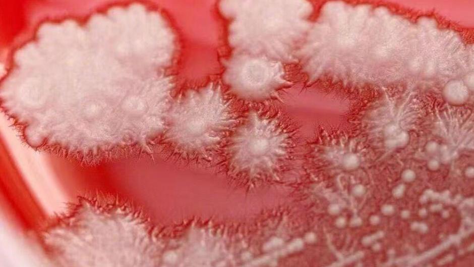 張男的咽喉布滿白色斑點，宛如雪花。（圖/翻攝新浪微博）