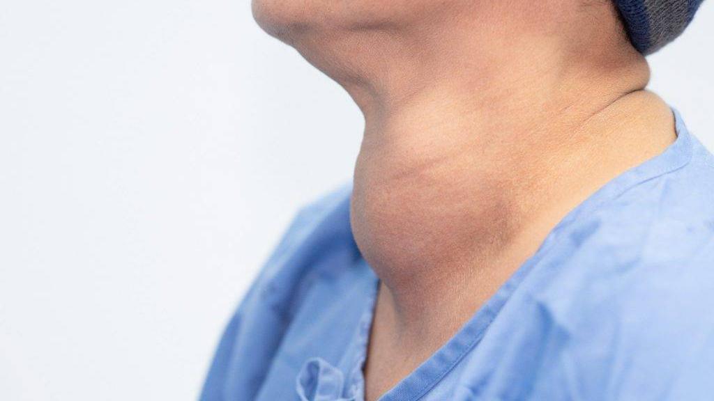 甲狀腺亢進的治療主要目標是讓荷爾蒙分泌恢復平衡，並減少對身體的過度刺激。