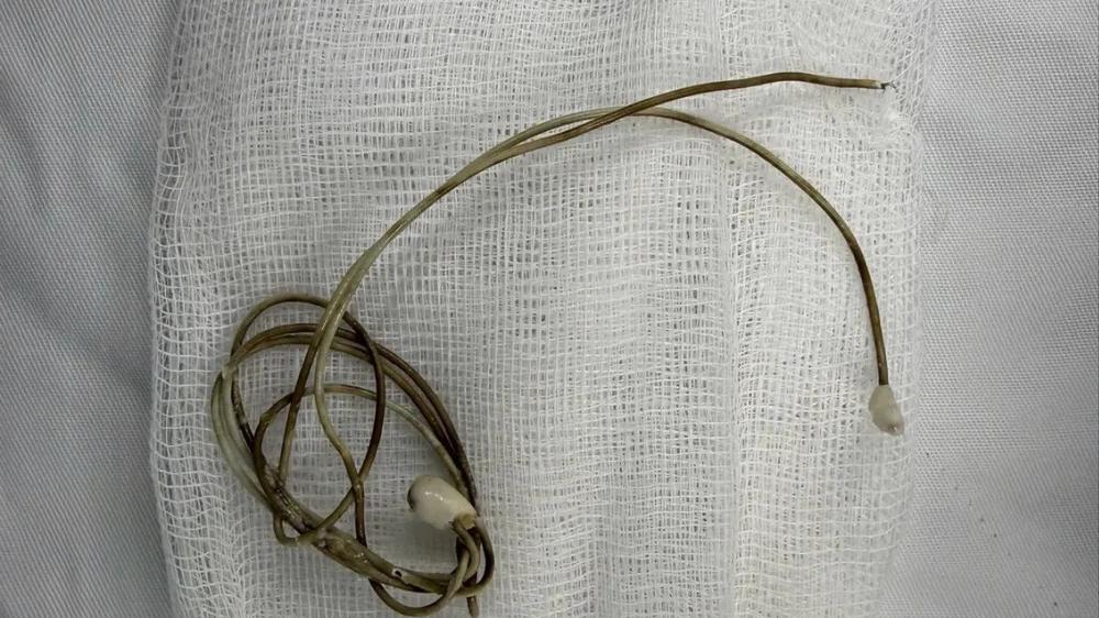 少年將電線插尿道求刺激，意外卡膀胱要開刀。(FB)