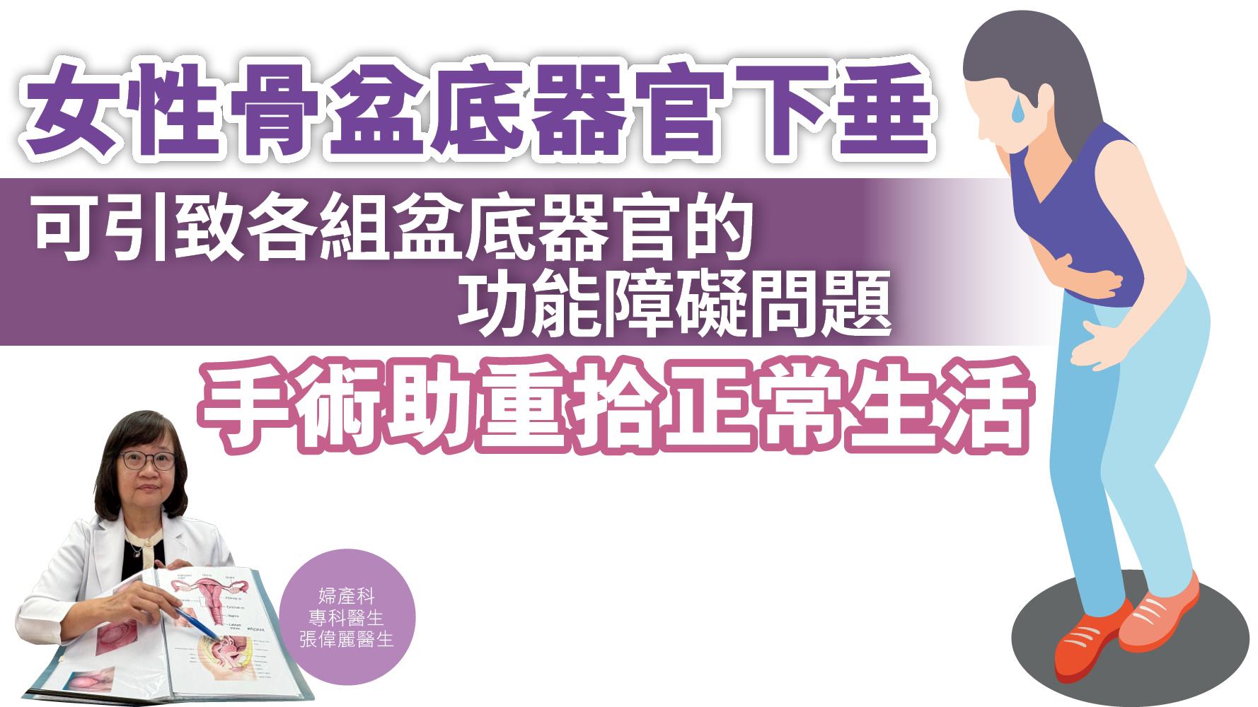 健康解碼｜女性骨盆底器官下垂 可引致各組盆底器官的功能障礙問題 手術助重拾正常生活