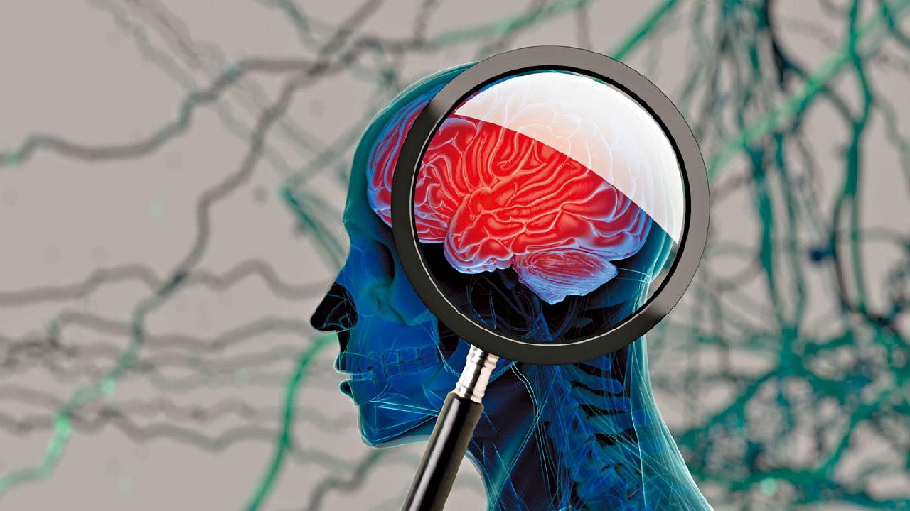 八成人不了解阿茲海默症 或致延遲就醫