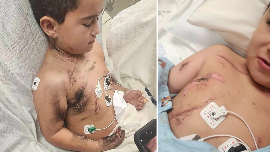 美8歲童睡夢翻身「項鍊卡插座」遭電擊　關鍵動作救回1命