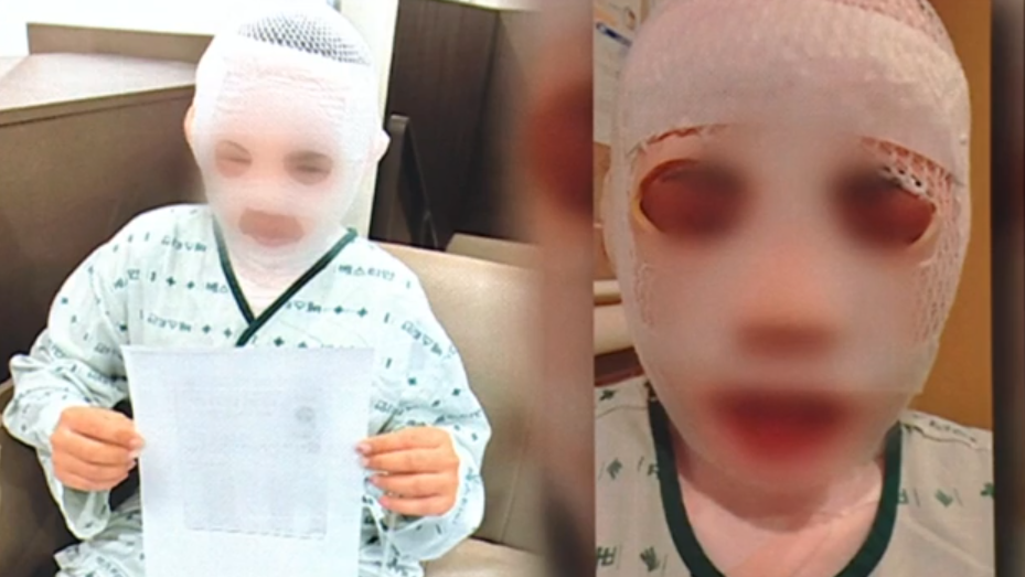 韓男趁妻子熟睡淋滾水 稱「變醜就離不開我」