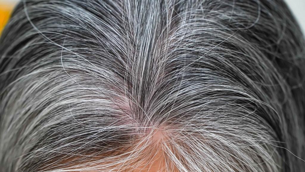 白髮叢生點算好？3招助你對抗黑髮變白 亂拔隨時惹來毛囊炎