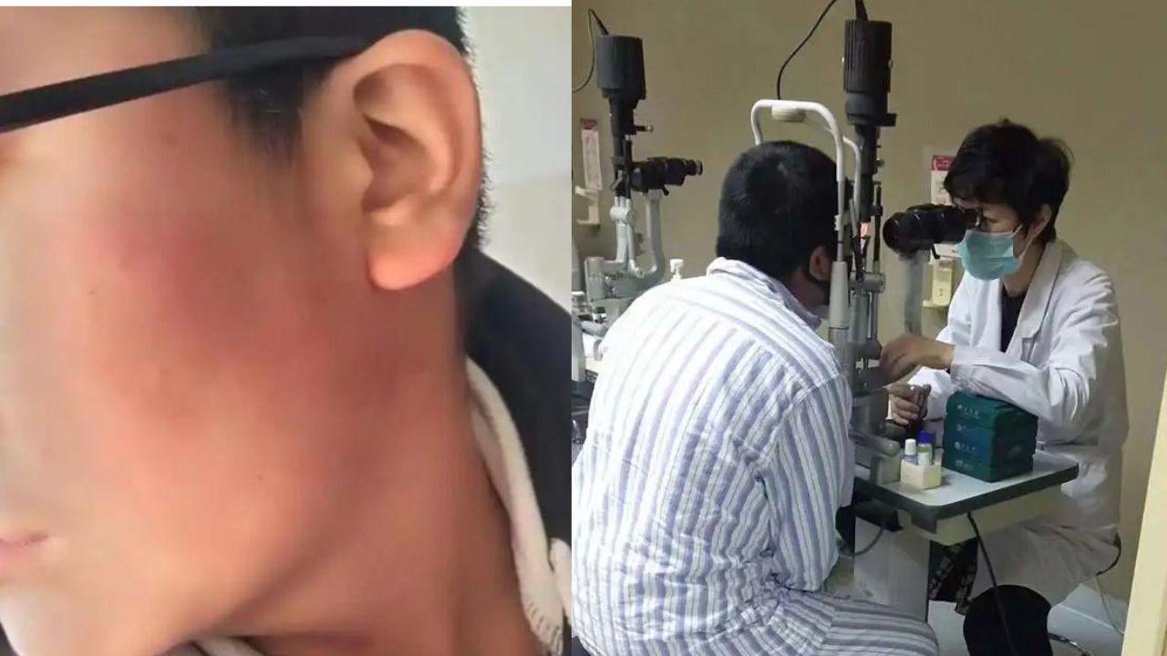 13歲學生被老師掌摑致眼晴近失明　湖北學校賠償70.6萬