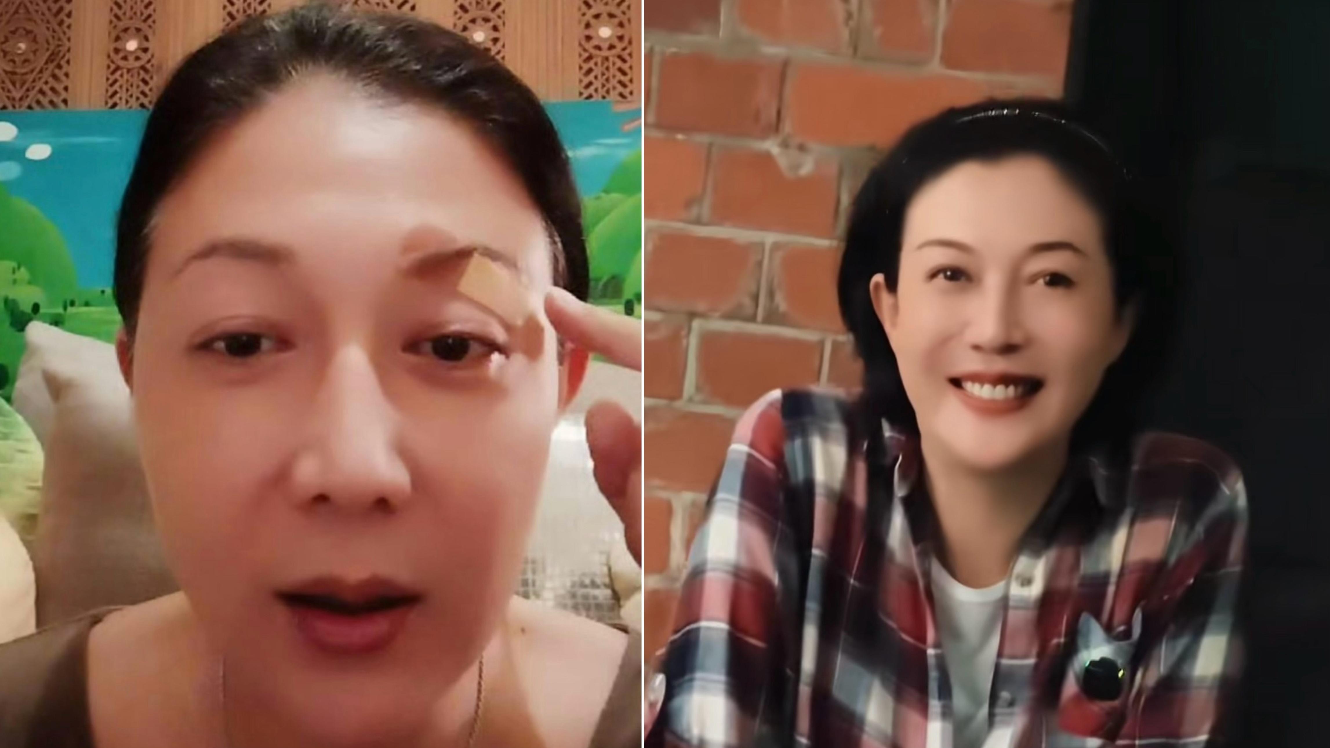 吳綺莉驚爆左眼險失明 穿樹叢遭尖銳樹葉刮傷