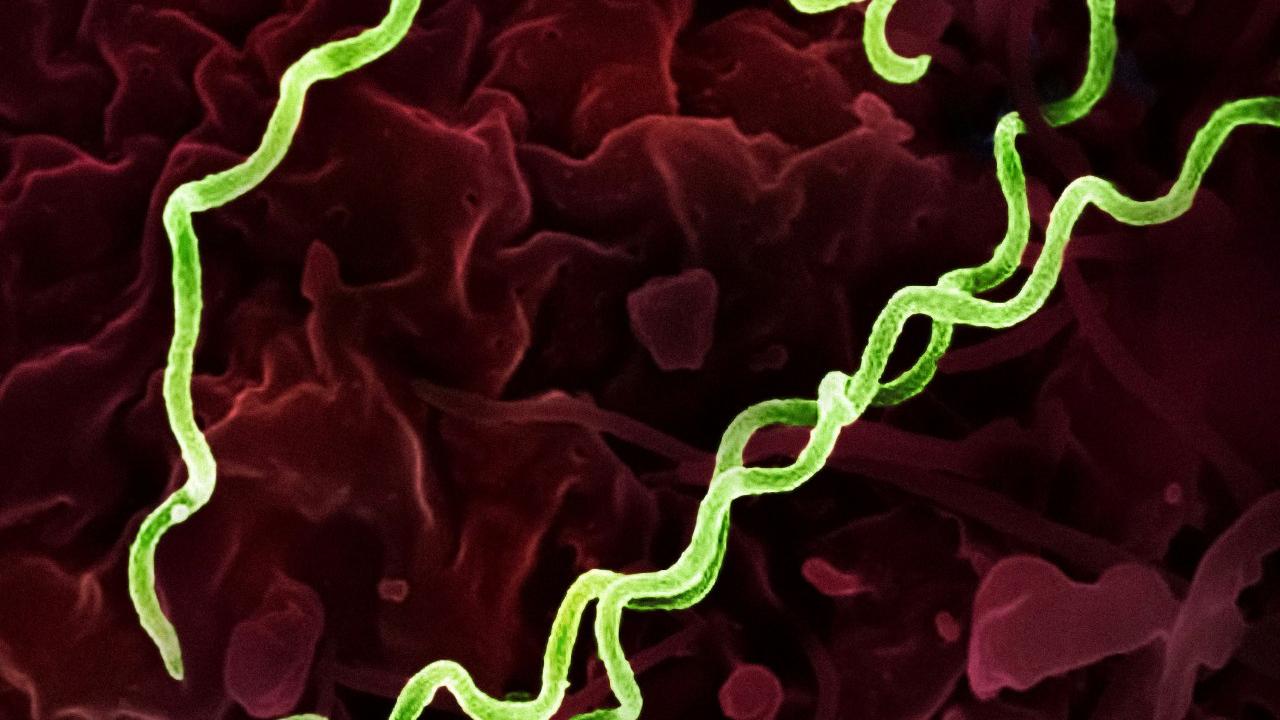 4歲女童染梅毒　原因竟是嫲嫲「用嘴餵飯」經口水傳染