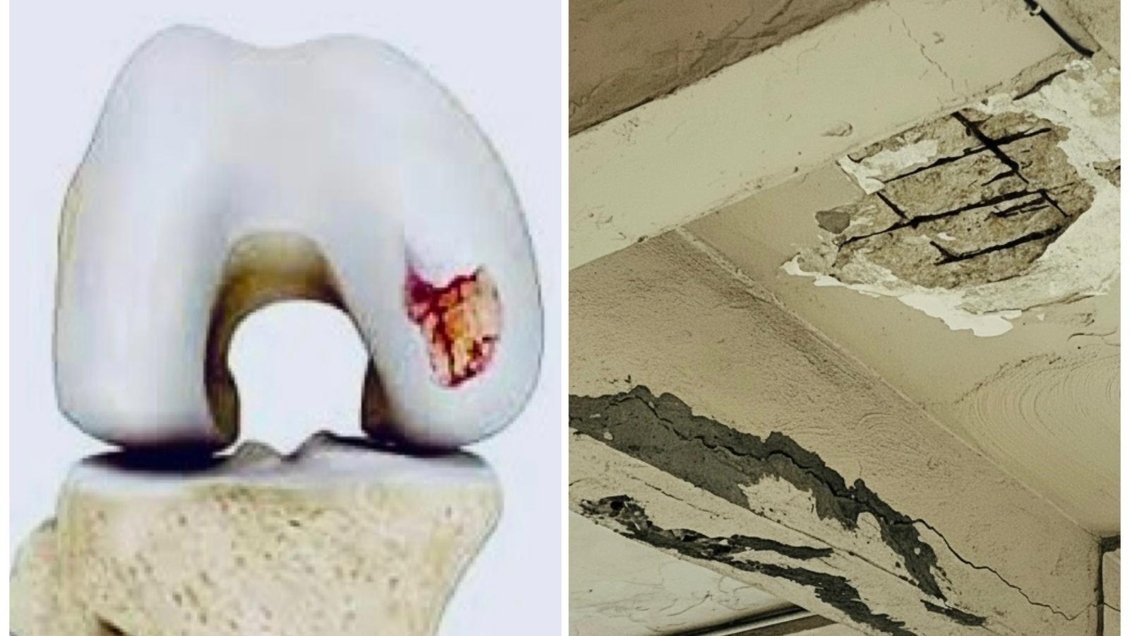 膝關節大維修事件簿