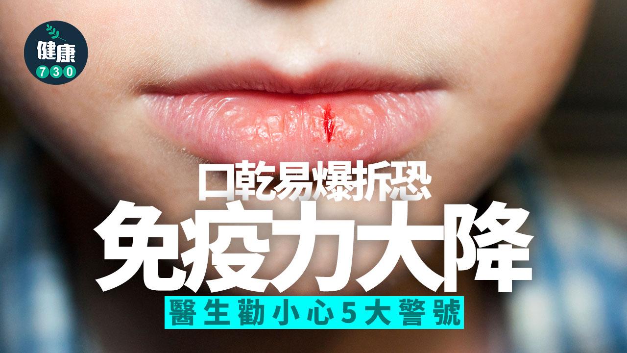口乾 唇角破裂 免疫系統失調 免疫力 免疫力降