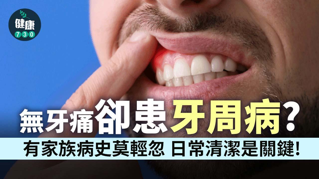 牙周病成因｜沒有牙痛卻患上？醫生解釋關鍵：小心遺傳（am730製圖）
