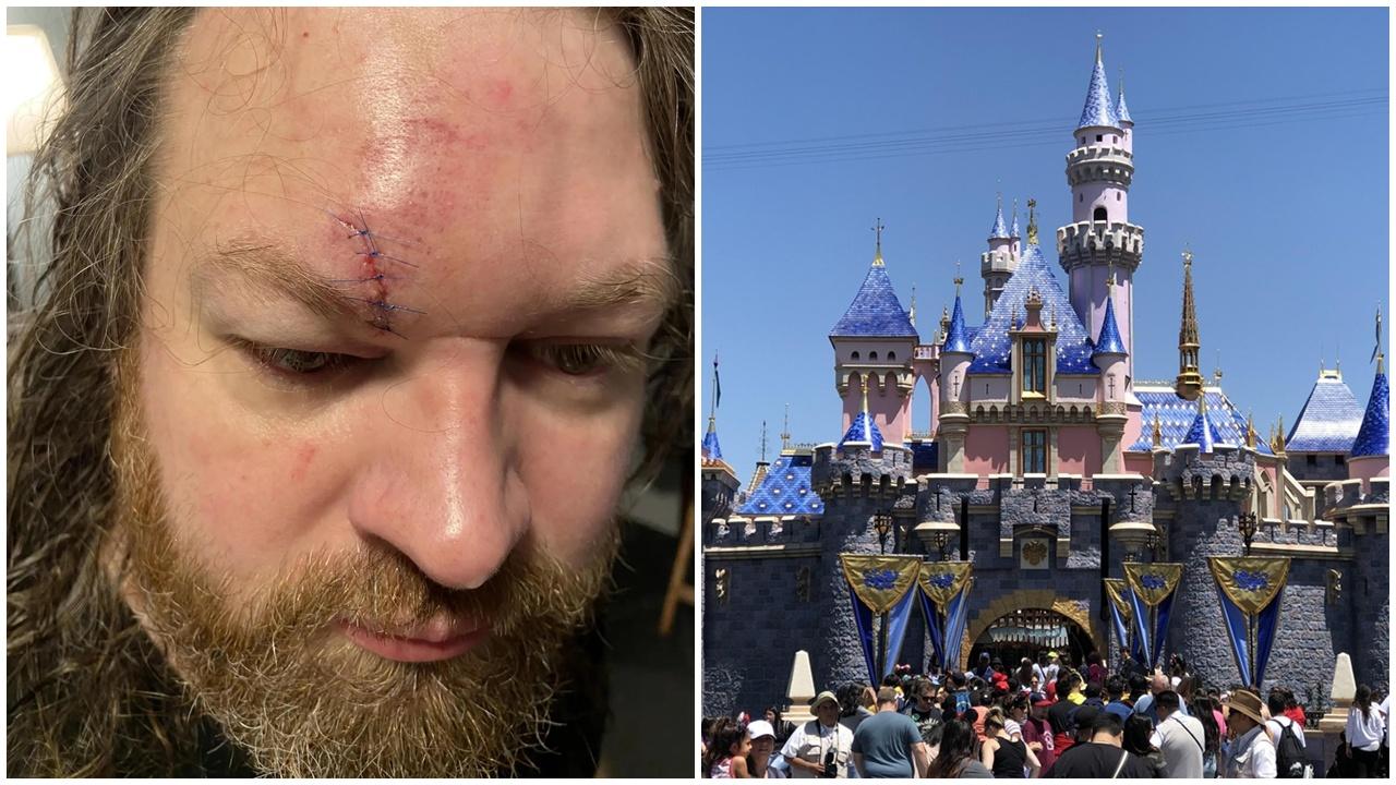 壯漢迪士尼阻插隊遭毆打浴血堅拒還手，妻子透露背後原因。