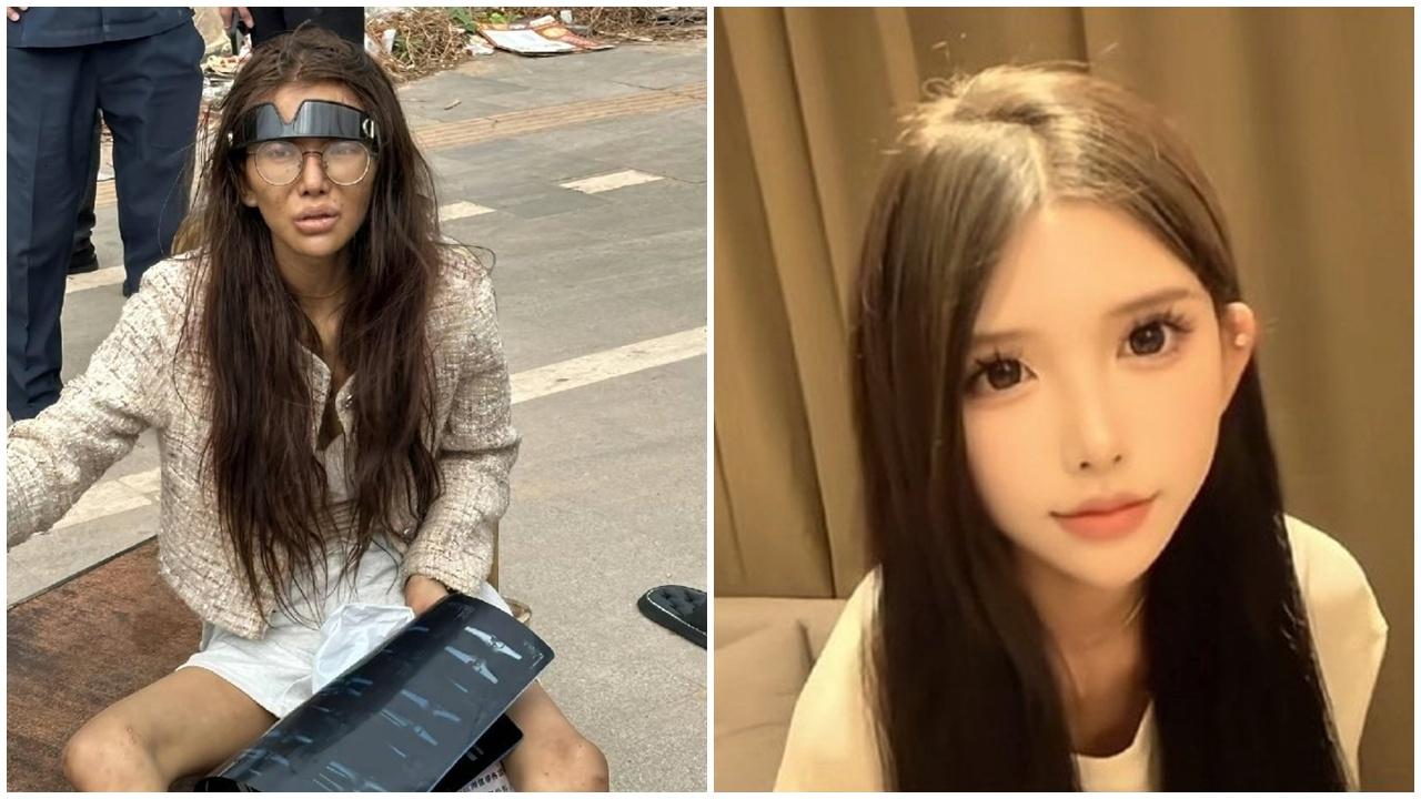 內地女網民疑被男友騙到柬埔寨，廿多日慘雙腿骨折流落街頭。(微博)