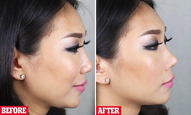 YouTuber試用新美容神器 唔使開刀30秒變高鼻 