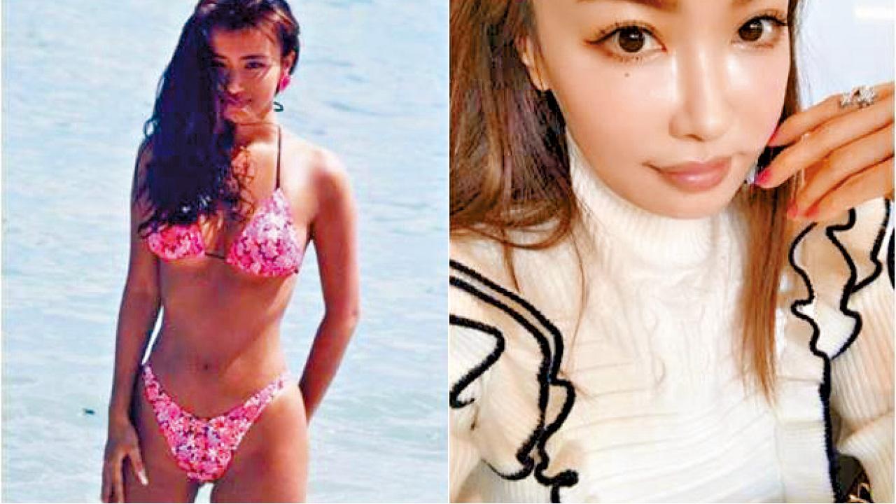 平子理沙被整容醫譏「怪獸咀」