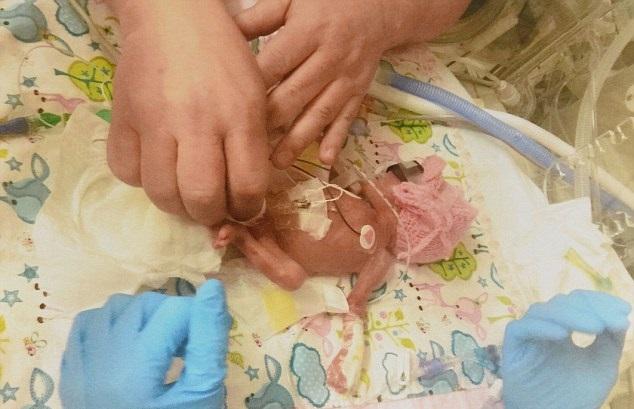 最袖珍大禮物 24周出生奇蹟