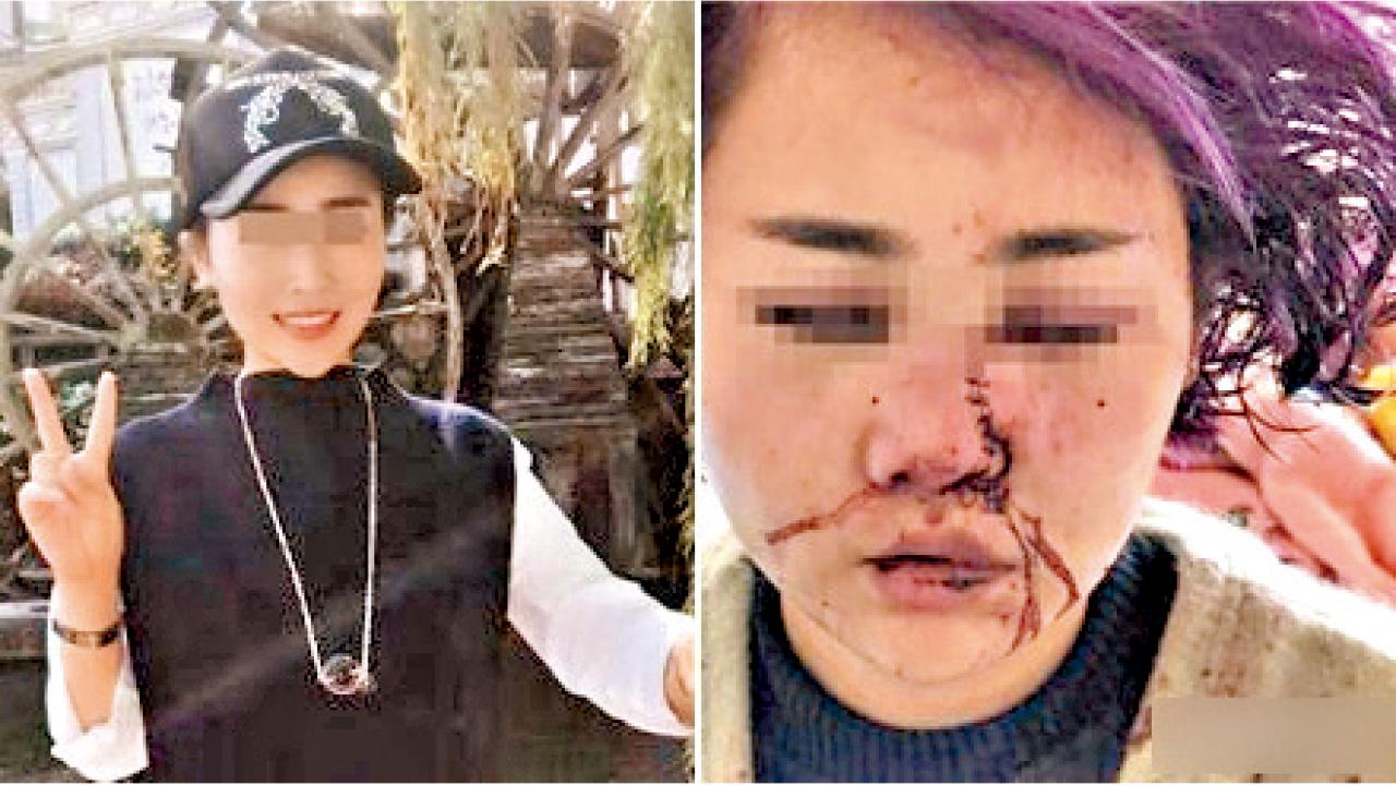 遊麗江被打致毀容 警方鑑定粵女屬輕傷