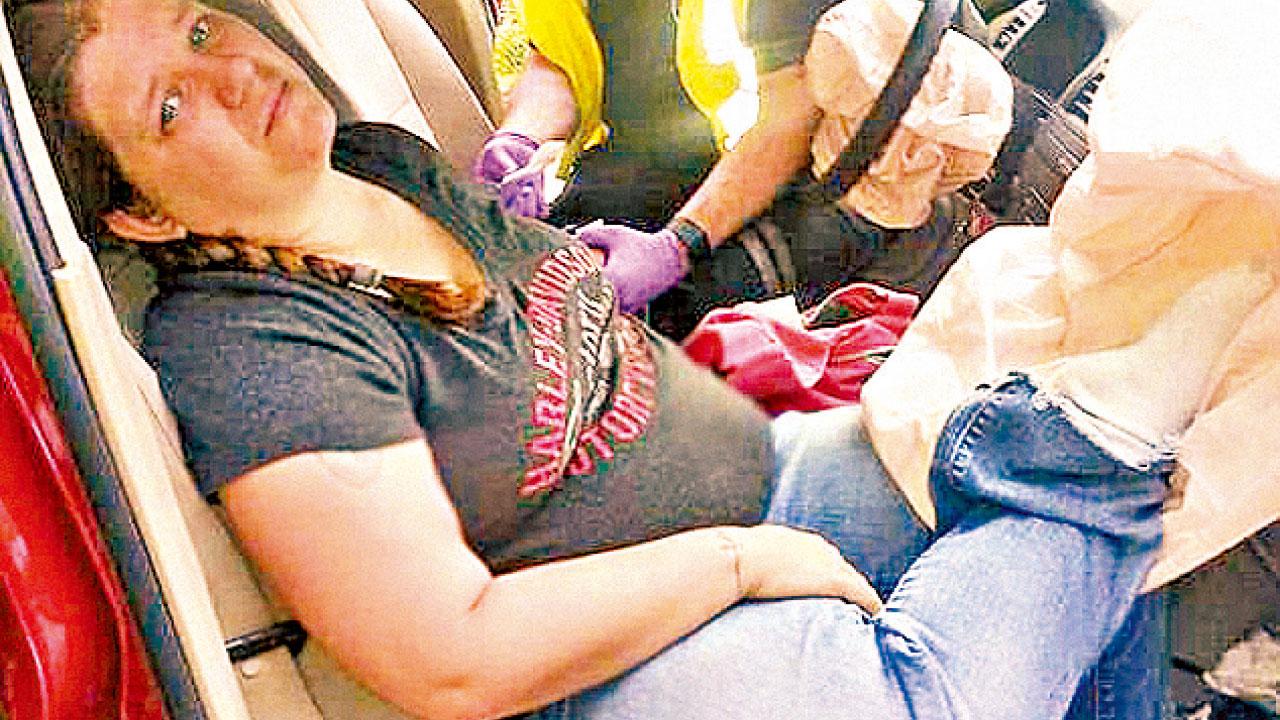 鼻腿踝斷骨鑲釘 蹺腳坐車致傷殘