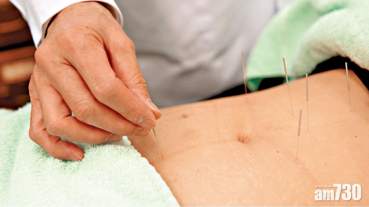 落針淺 風險低 腹針治頸痛療效顯著
