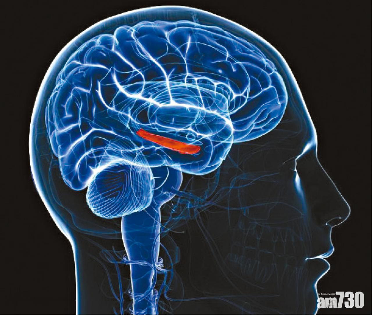 記憶義肢激發腦力