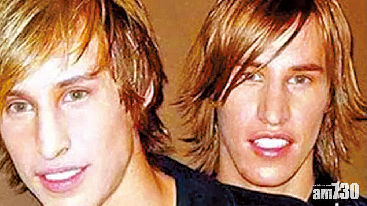 孖仔整容仿製畢佬