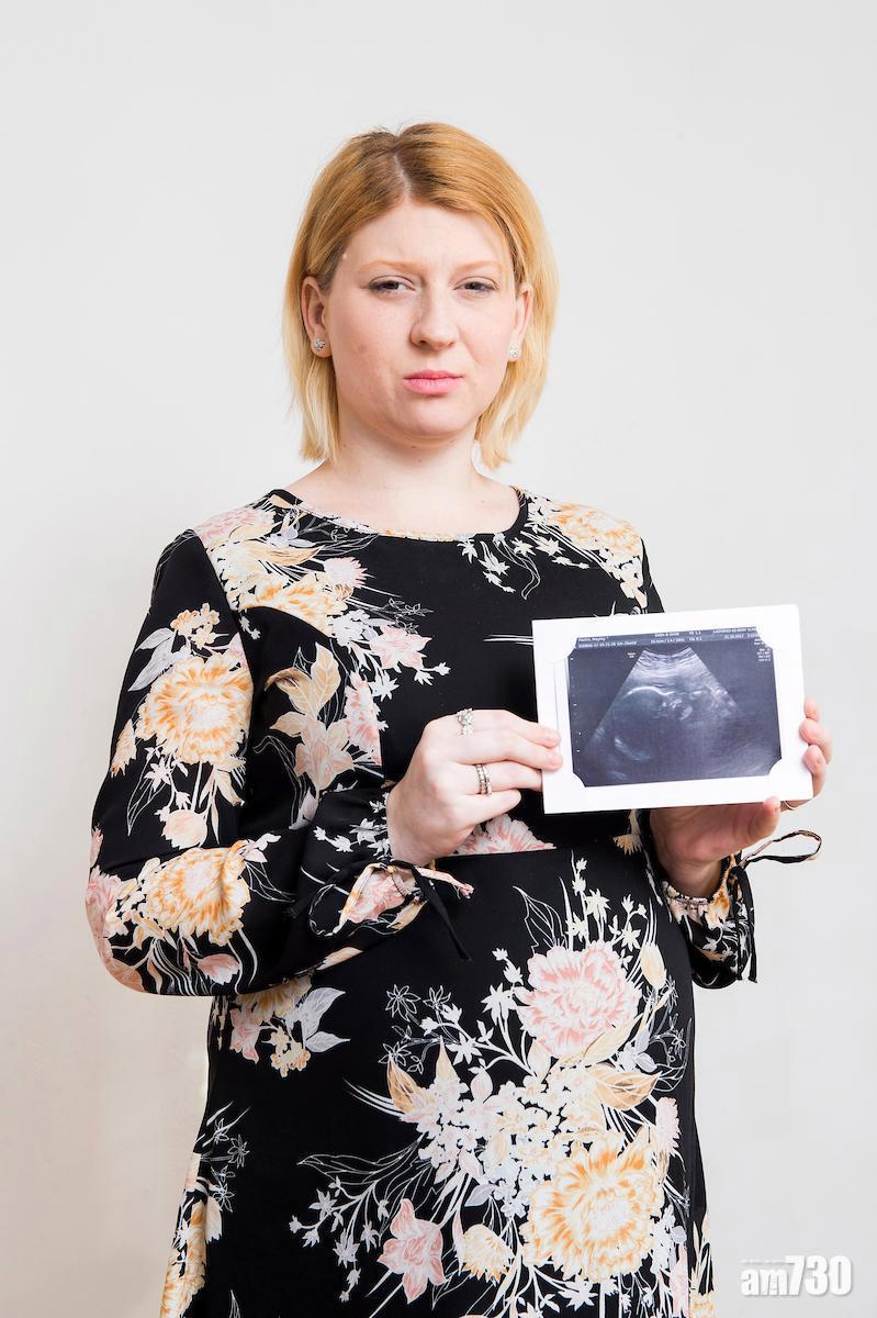 知悉胎兒出世會夭折 母照生冀捐器官救人