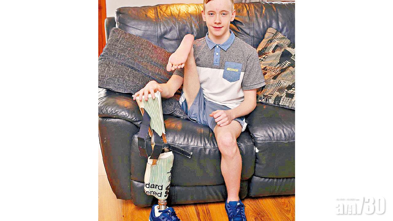 患癌截大腿 腳掌跟代膝蓋接義肢