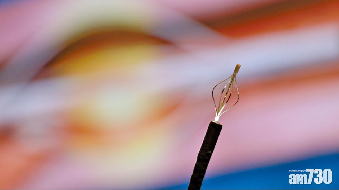 適用於嚴重病患者 新技術減哮喘發作