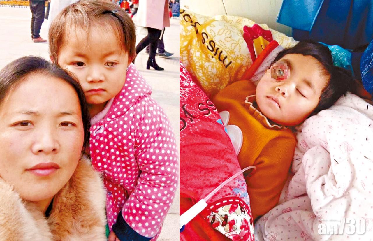 廣籌醫藥費拒治療  狠母疑靠眼癌女騙財