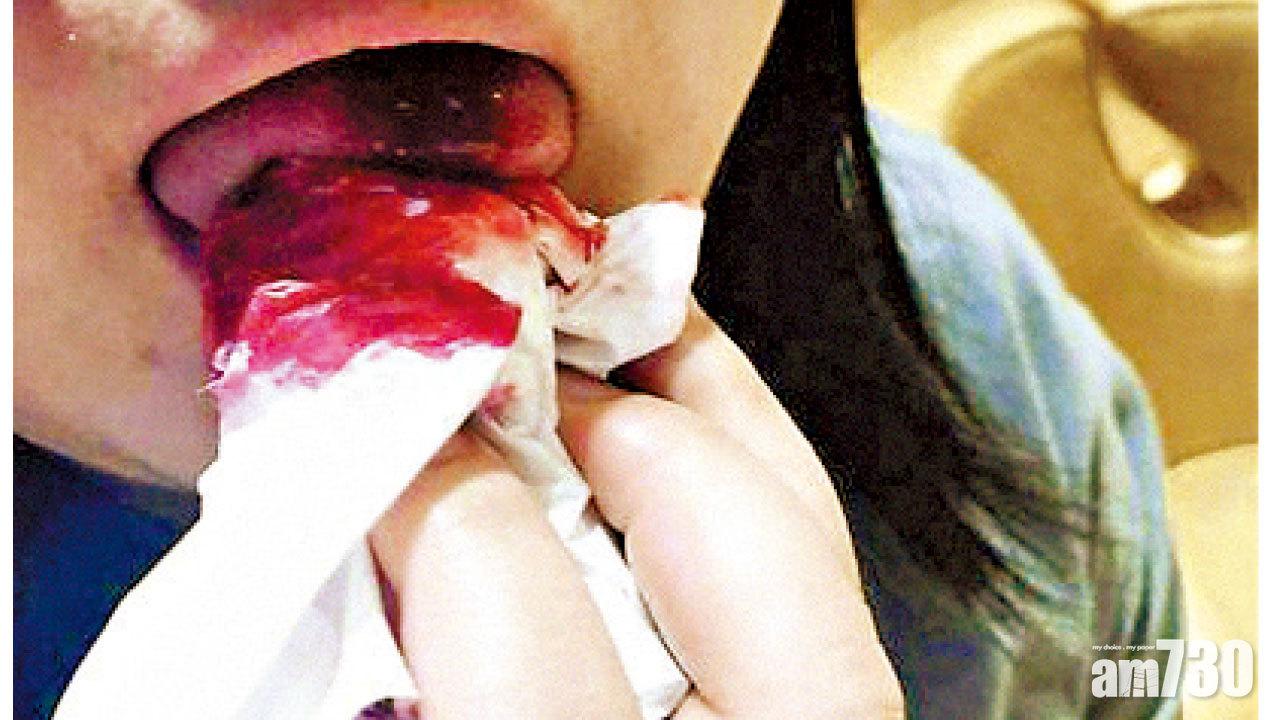 疑食到玻璃碎傷脷  滬女促哈根達斯賠1萬元