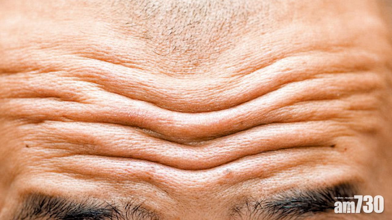 額紋深 心臟病風險高