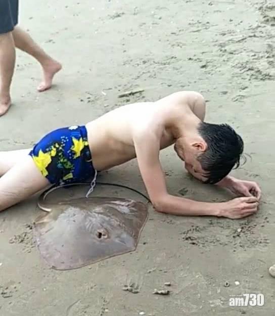 男子三亞暢泳 慘遭魔鬼魚刺傷下體