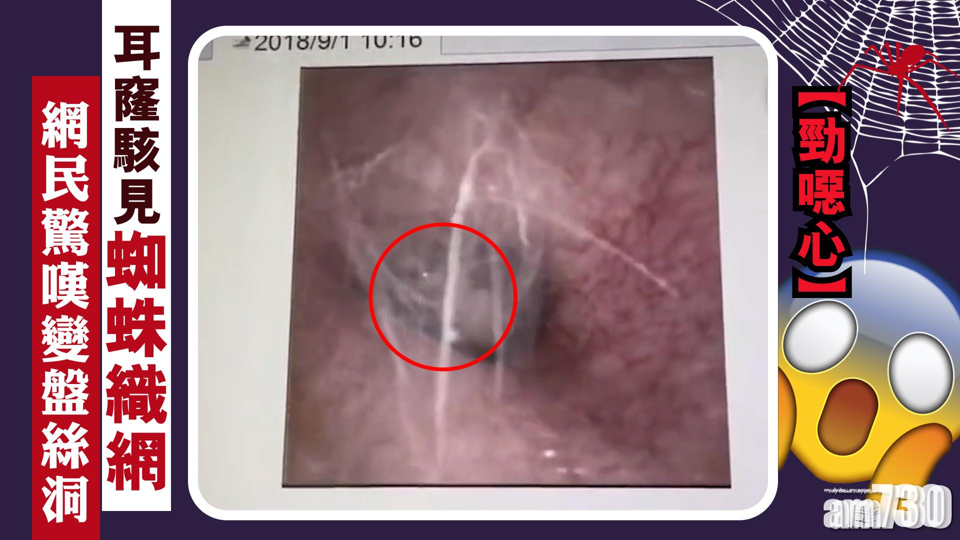 【勁噁心】耳窿駭見蜘蛛織網  網民驚嘆變盤絲洞