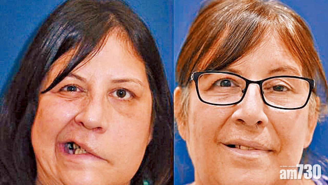 自己神經自己駁