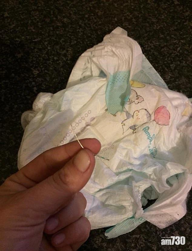 【刮損晒】寶寶換片後不適 母驚覺Pampers藏針