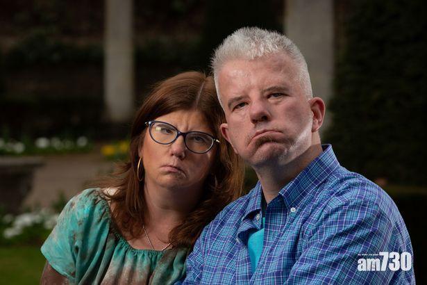 【不能笑的情侶】罕見病男覓得同病女友 約會4次後訂婚