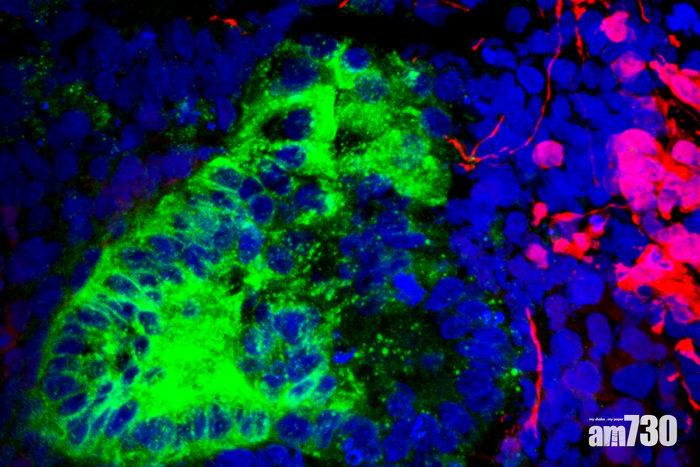 【恐怖醫學？】幹細胞培植人造腎 點知長出腦細胞同肌肉細胞