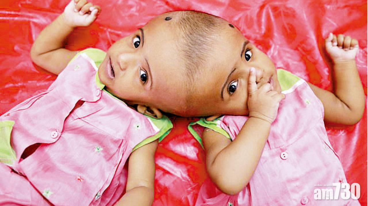 五死一生的分割