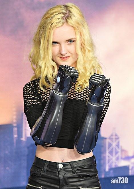 占士金馬倫送她一雙手 現實版銃夢