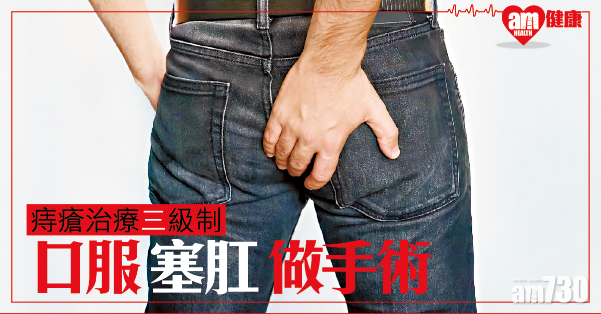 痔瘡治療 因人而異