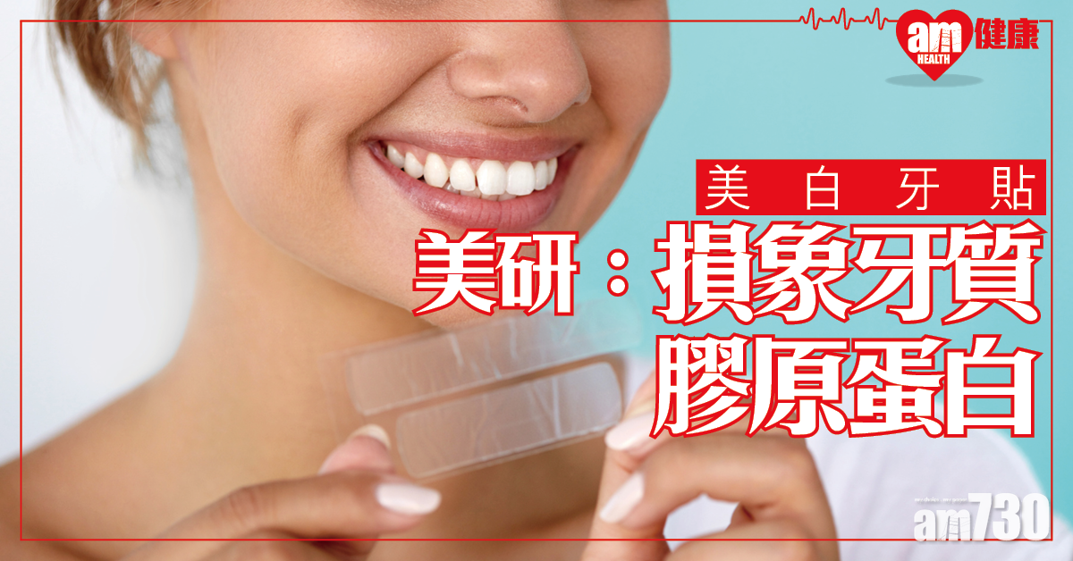 【美白牙貼】關鍵成分 可損象牙質膠原蛋白