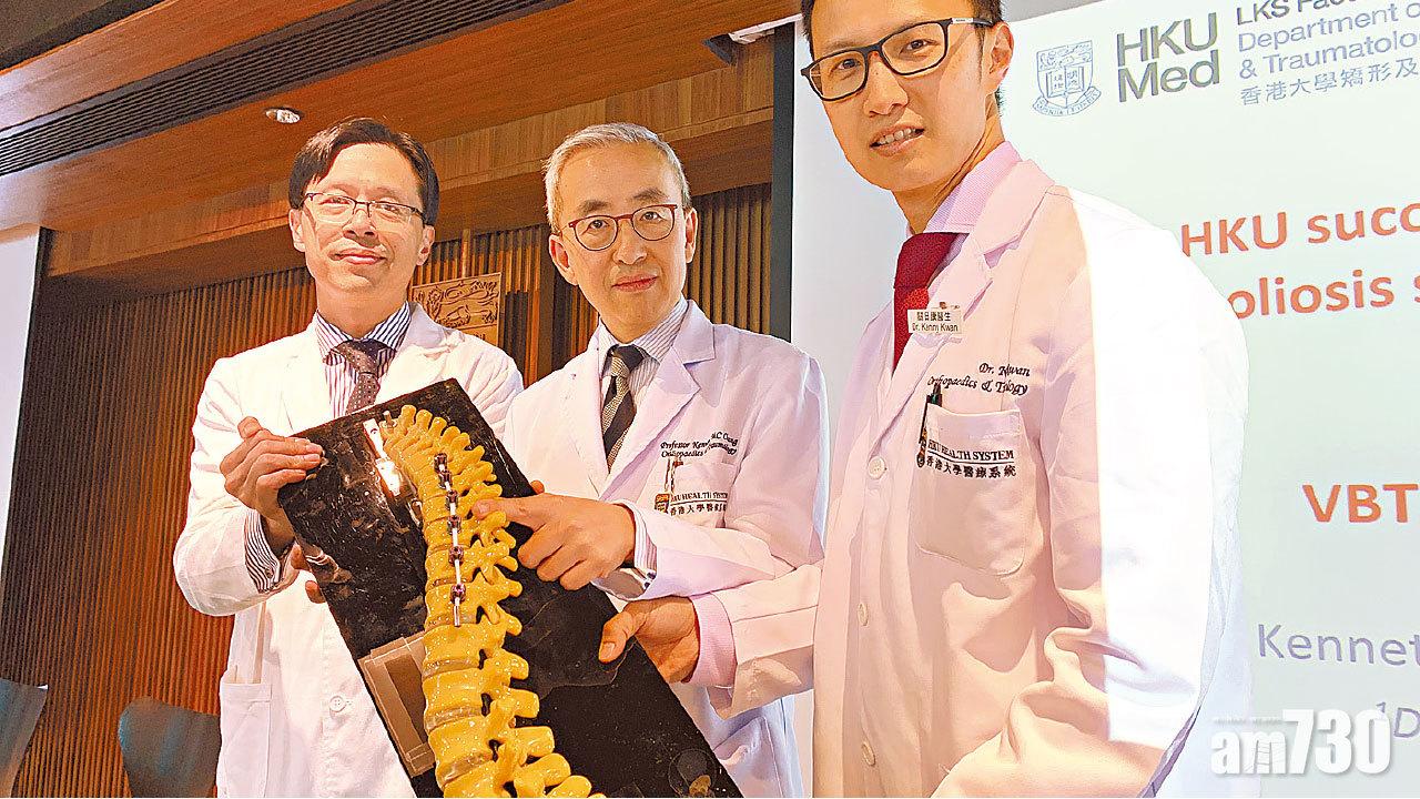 引VBT技術治兒童脊柱側彎  港大︰活動能力如常