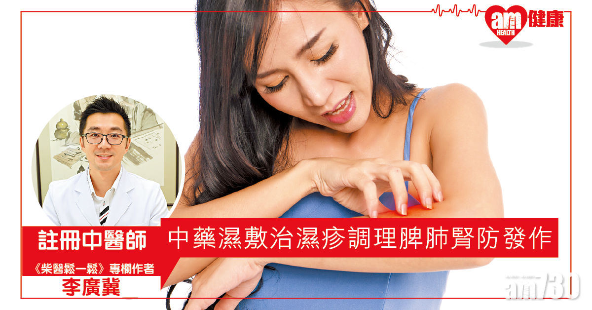 濕疹｜3招教你預防濕疹發作 唔用類固醇可以點？